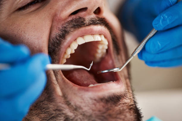 Best Broken Tooth Emergency  in Linn, MO